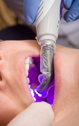How to Make Sure You Care for Composite Fillings Properly