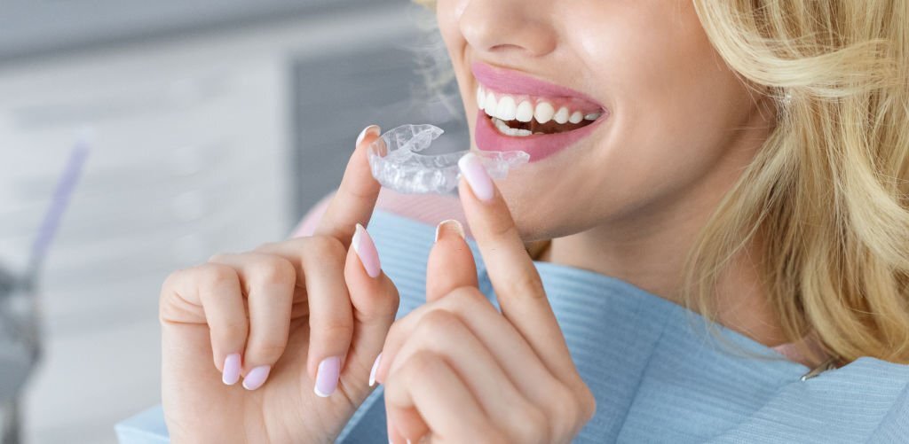 Simple Steps to Know How Invisalign Aligners Work