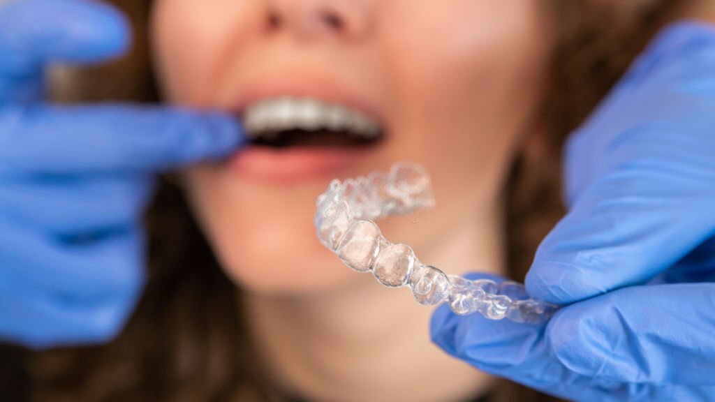 Pros & Cons Of Invisalign Braces Treatment