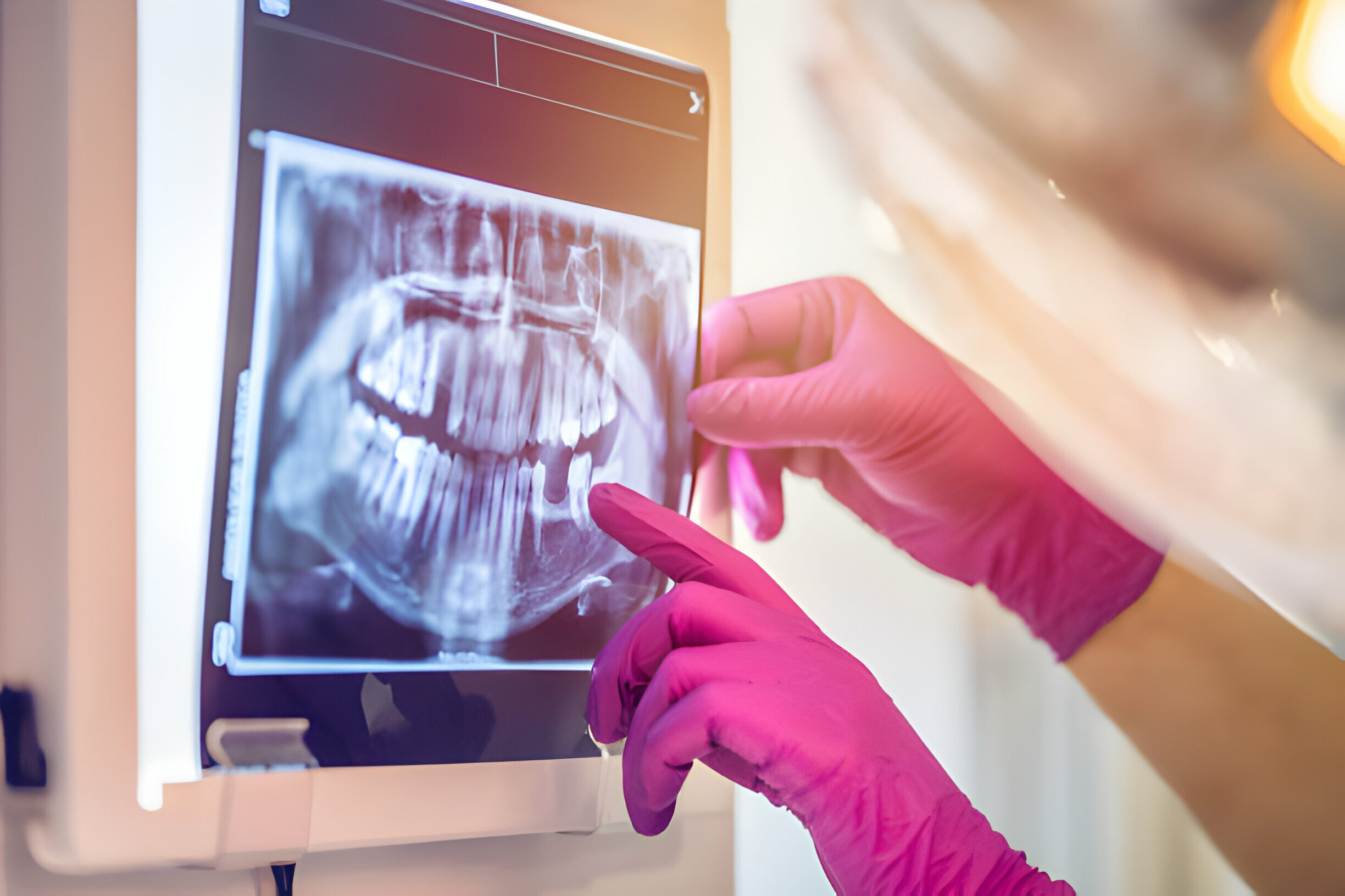 Different Types of X-Rays by Dental Summerville, SC_FI
