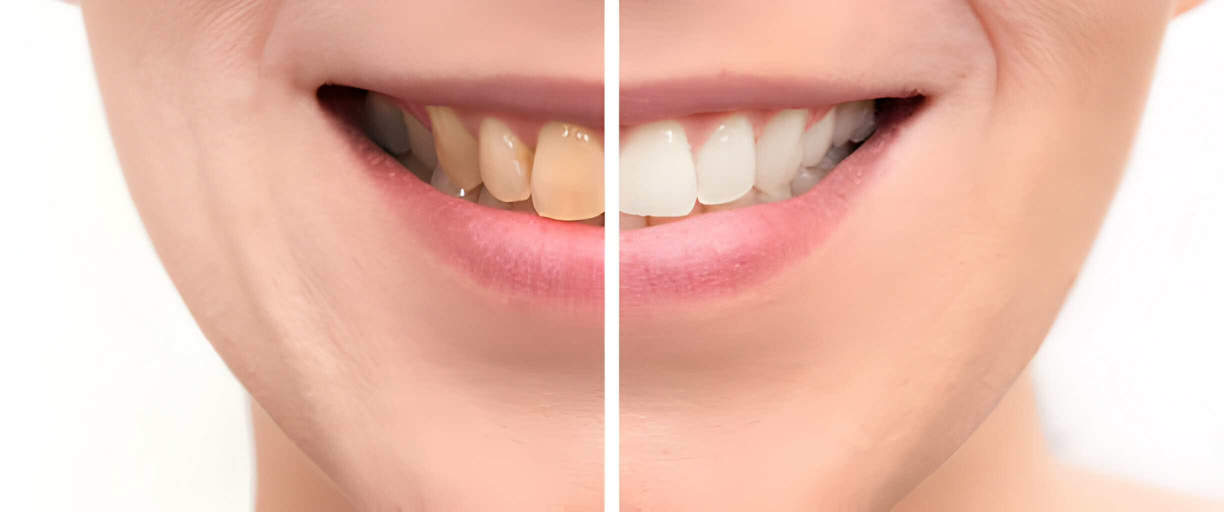 Unlocking The Secrets Of Cosmetic Dentistry In Summerville, SC_FI