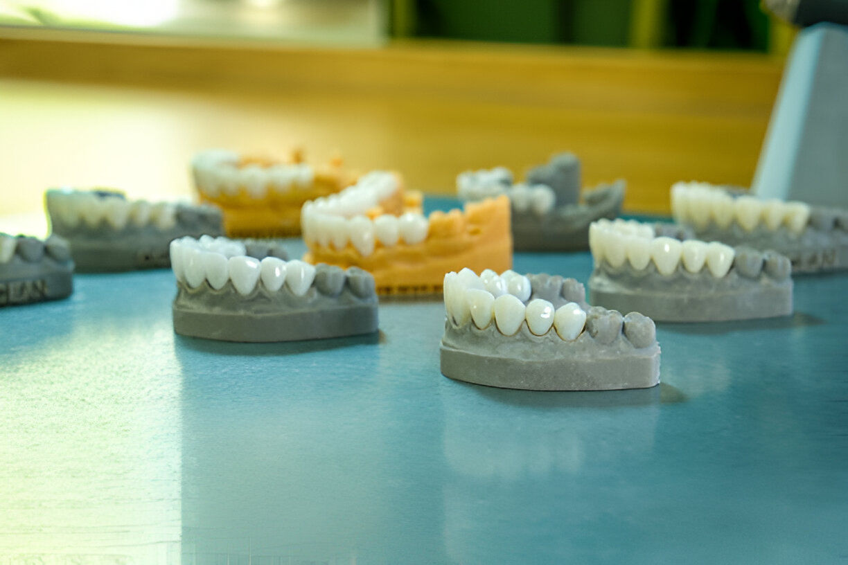 Restore Your Smile with Dental Crowns at Cane Bay Family Dentistry, Summerville,SC_FI