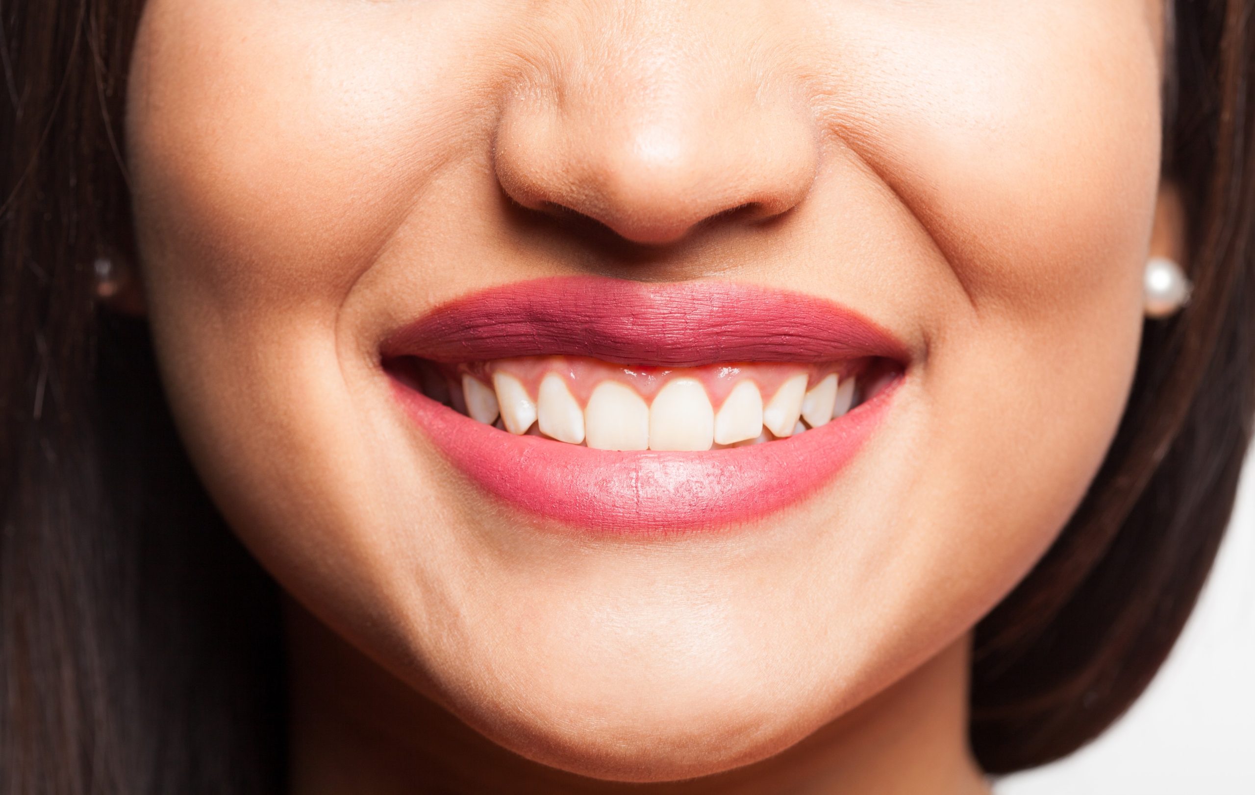 Professional Teeth Whitening in Summerville, SC – Why Patients Trust Cane Bay Family Dentistry_FI