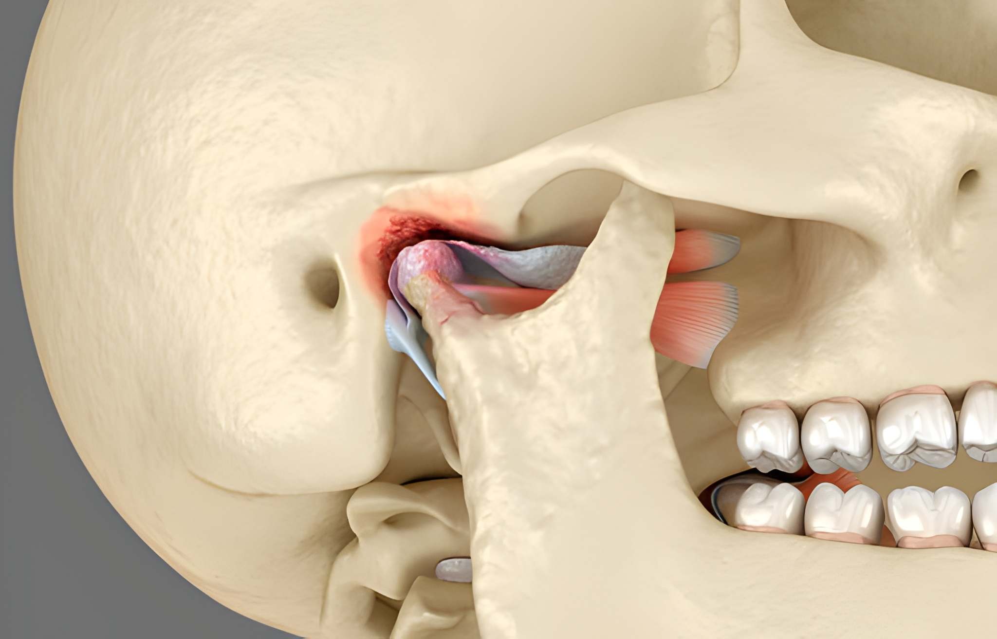 How TMJ Disorders Affect Daily Life - Insights from a Summerville, SC Dentist_FI